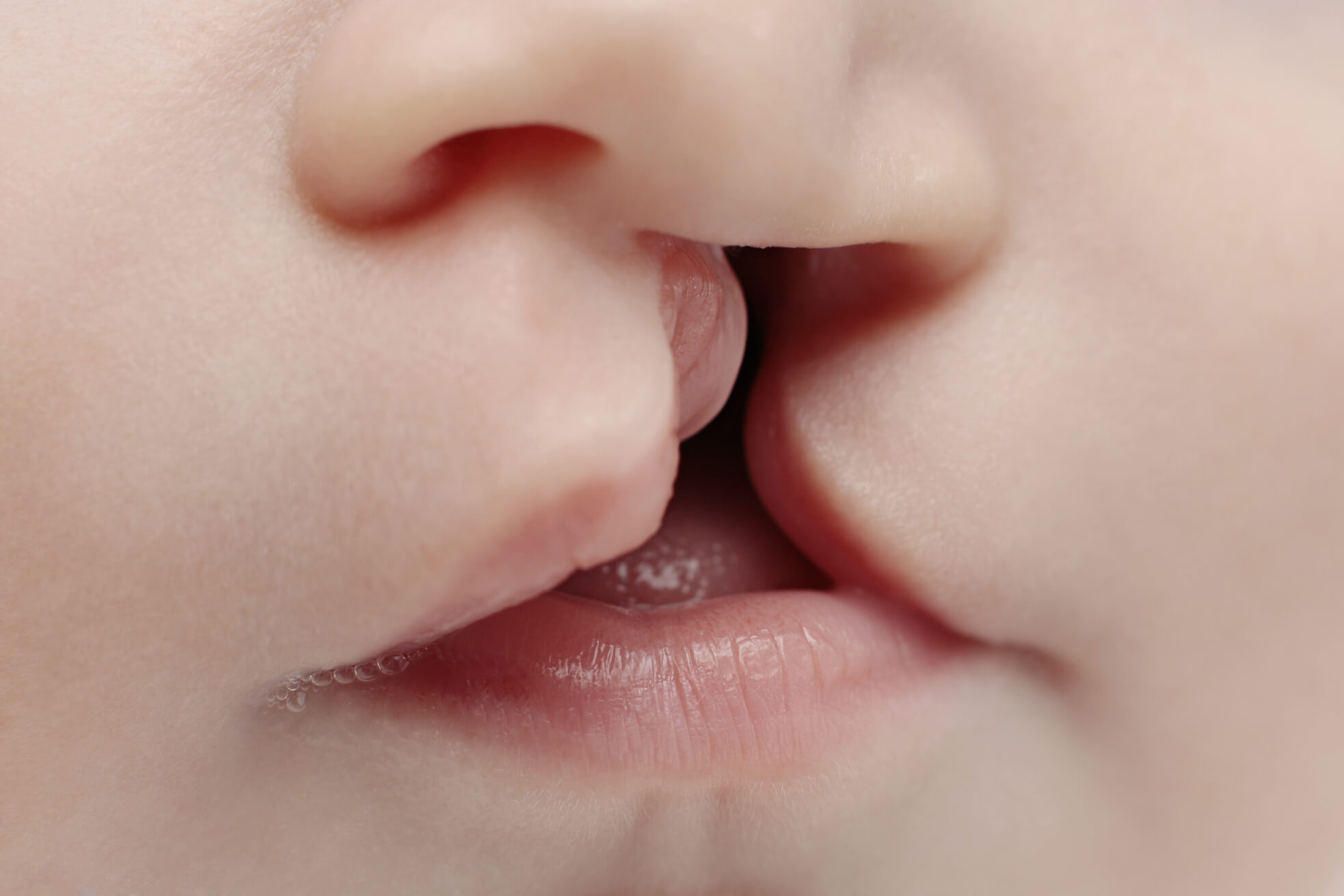 Rabbit Lip and Palate Deformities